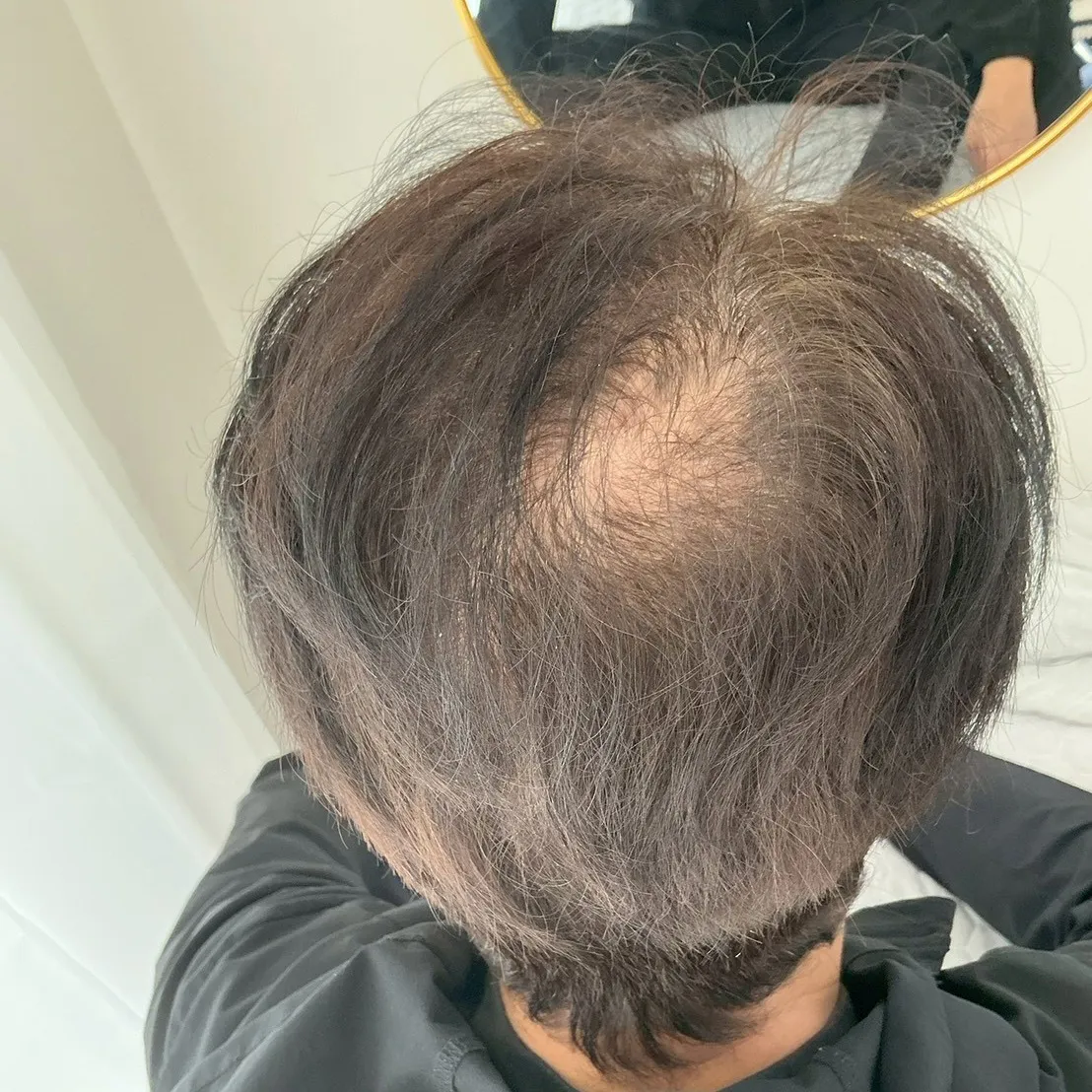 39C7190D-7109-4F30-961F-6B9F13EDBBAA