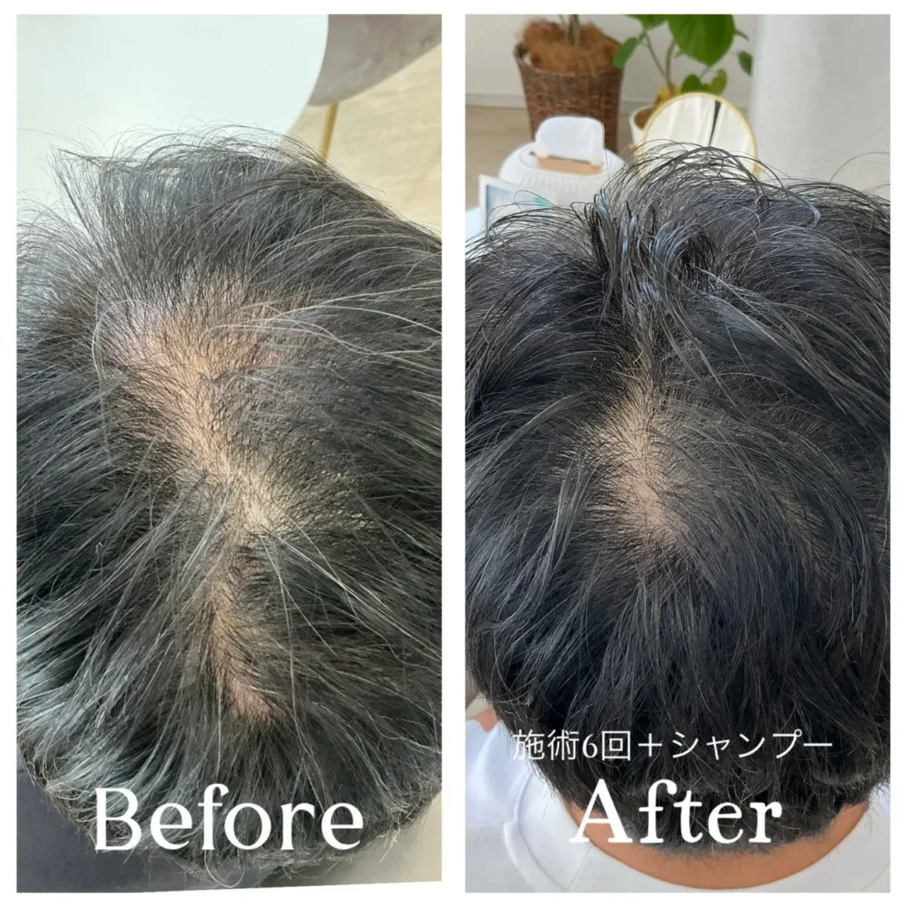 60代男性ビフォーアフター