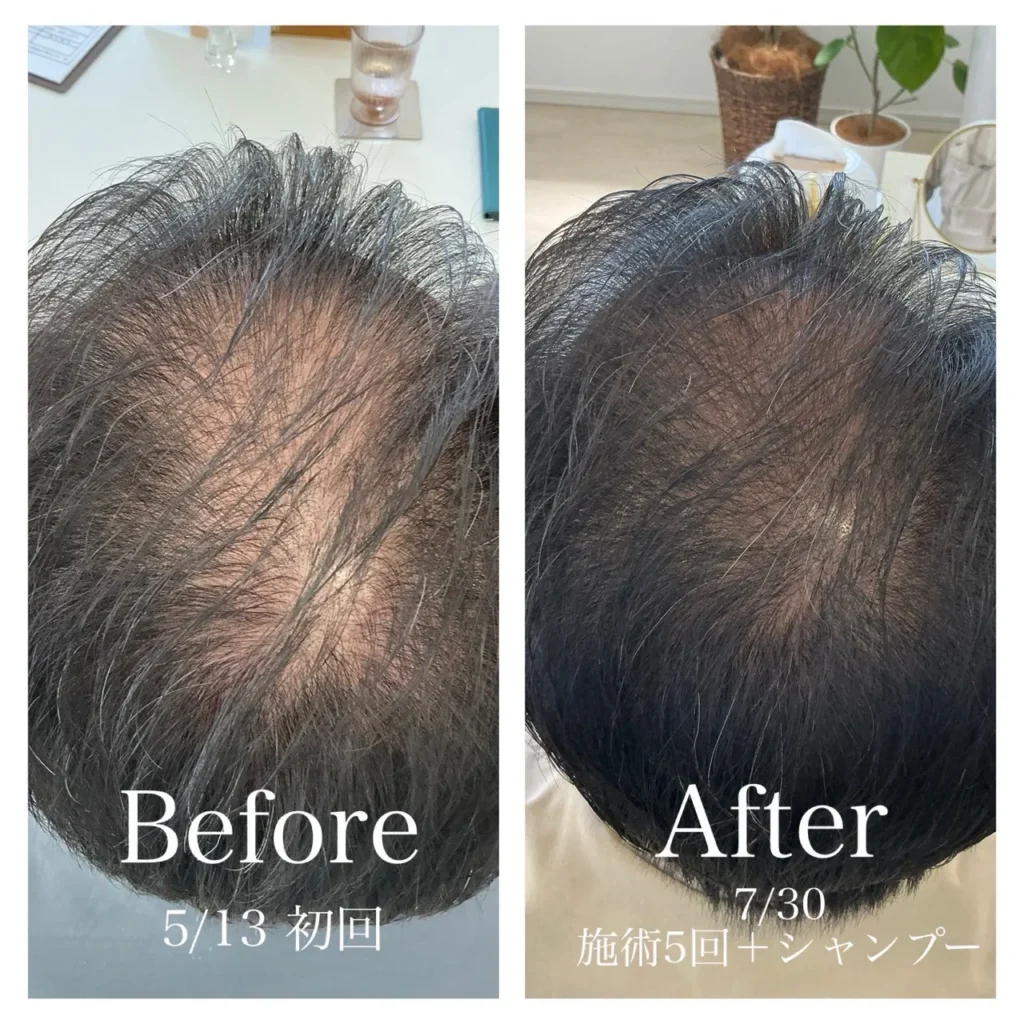 60代男性ビフォーアフター